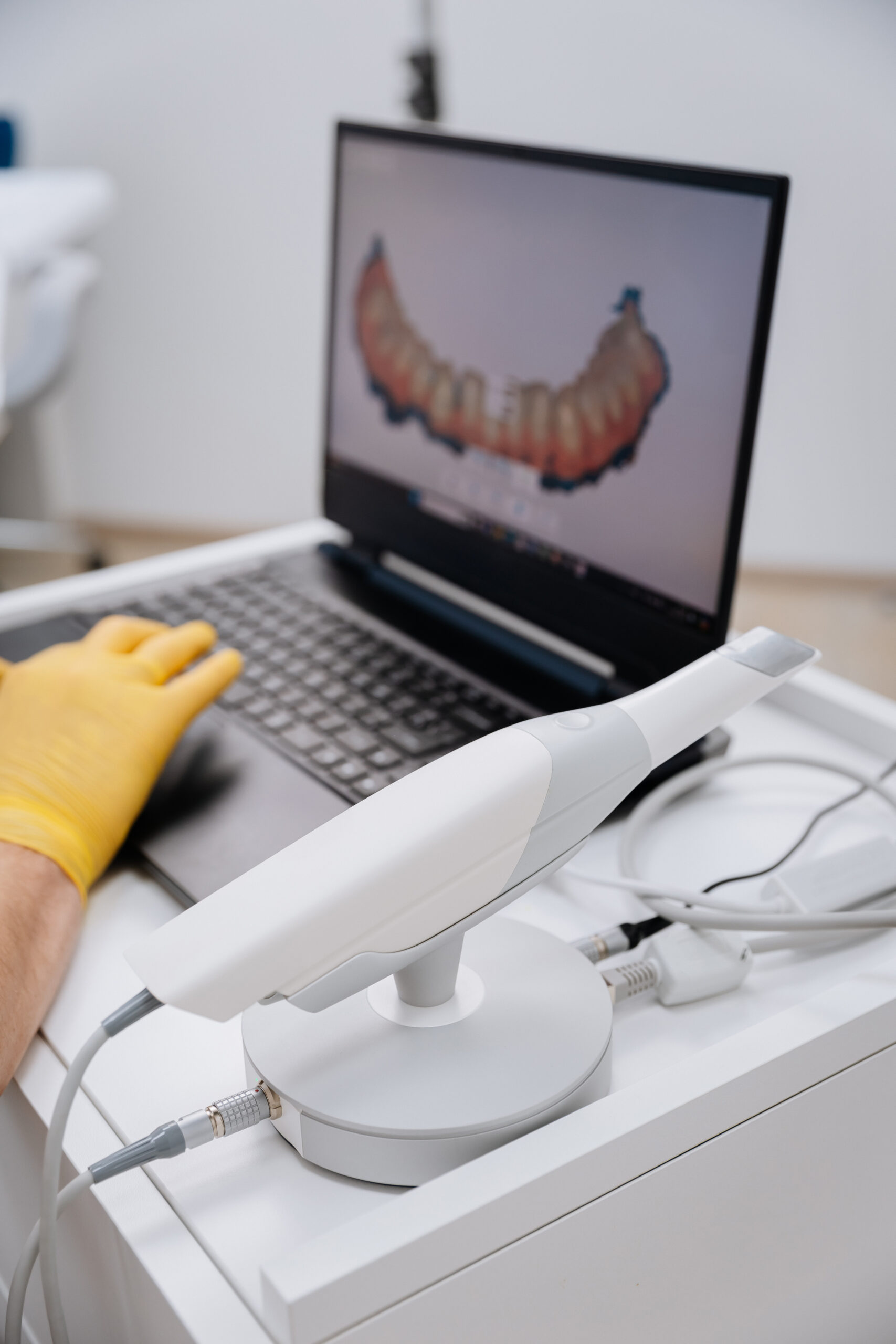 Advanced 3D dental scanner with digital teeth model displayed on a laptop in a dental clinic. High quality photo