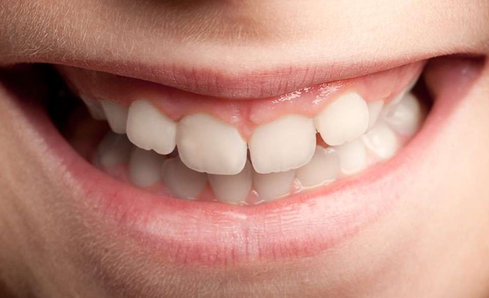 two children holding a picture of a mouth smiling isolated on white