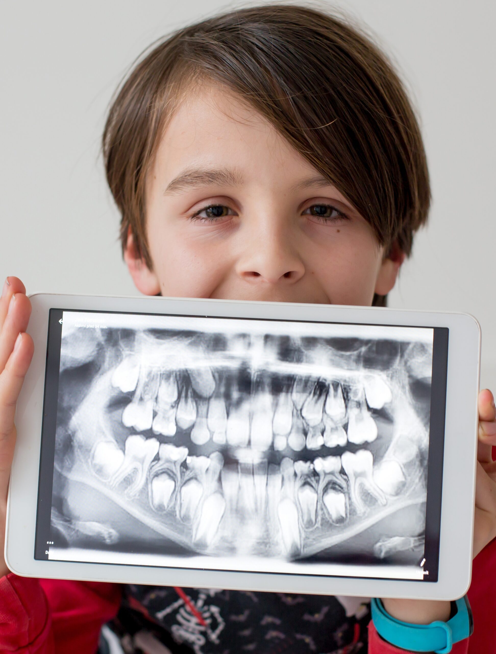 Child, preteen boy, holding tablet with a picture of his x-ray teeth