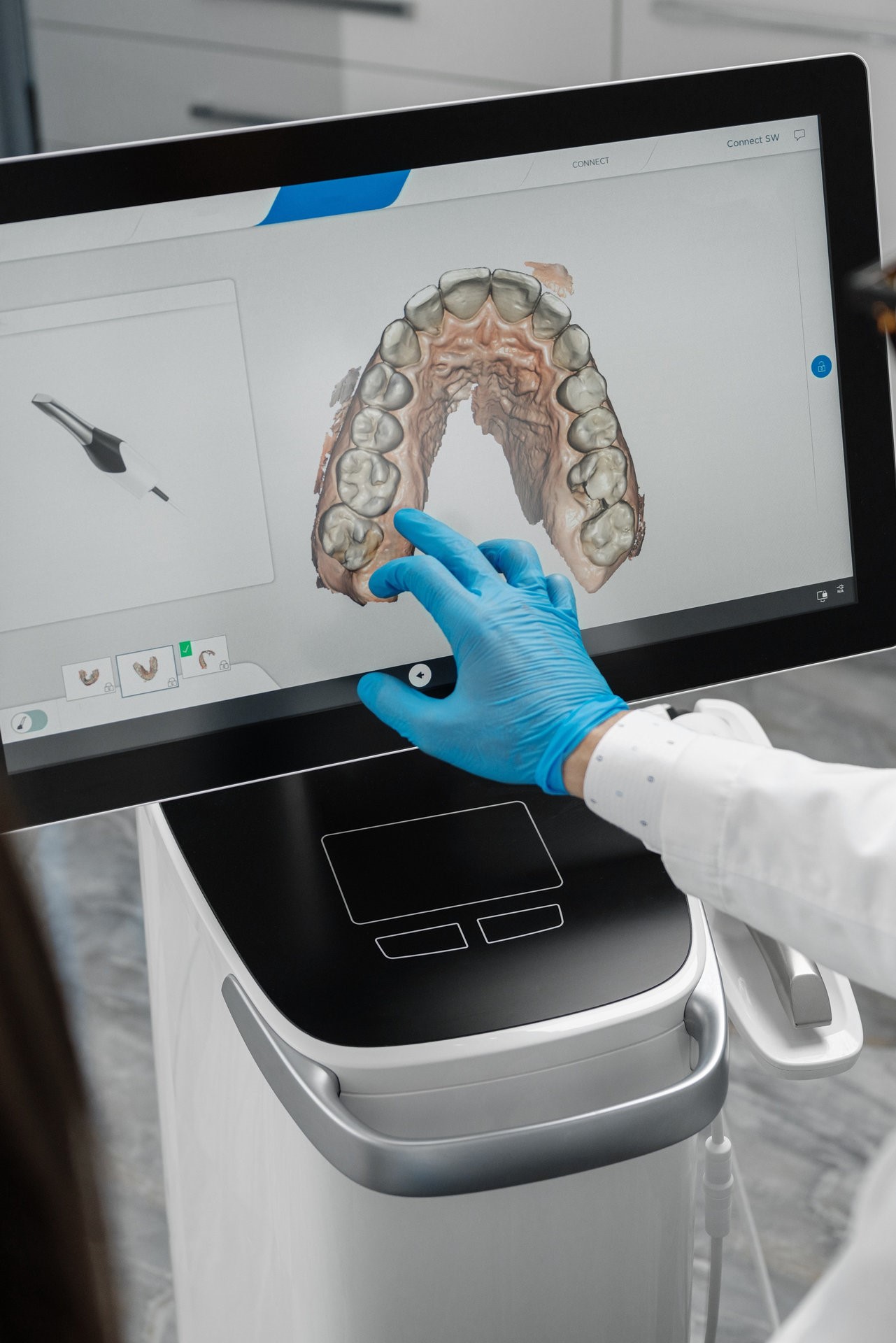 Male doctor show results of digital intraoral scan of patient teeth in 3D on display.